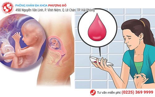 Ra máu, dịch màu hồng - dấu hiệu dọa sảy thai dễ nhận biết Ra máu, dịch màu hồng - dấu hiệu dọa sảy thai dễ nhận biết