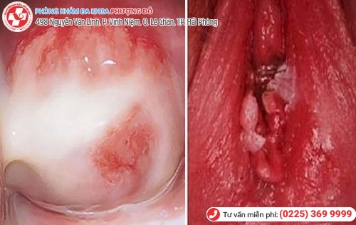 Đau vùng kín là dấu hiệu của bệnh gì? Đau vùng kín là dấu hiệu của bệnh gì?