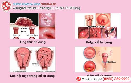“Đứng ngồi không yên” vì kinh nguyệt kéo dài tận 3 tuần “Đứng ngồi không yên” vì kinh nguyệt kéo dài tận 3 tuần