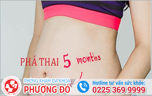 Hút thai 5 tháng có được không?