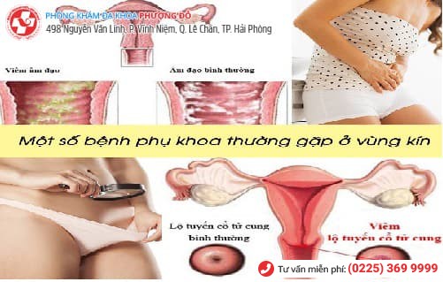 bệnh phụ khoa