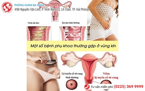 1 số bệnh phụ khoa ở vùng kín thường gặp ở chị em 1 số bệnh phụ khoa ở vùng kín thường gặp ở chị em