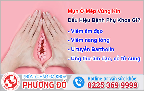 Mụn Ở Mép Vùng Kín 