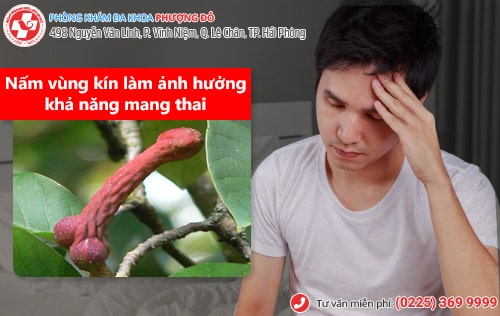 Nấm vùng kín ở nam, nữ - dấu hiệu nhiều bệnh nguy hiểm