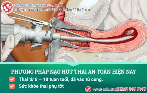 Địa chỉ hút thai an toàn, không đau uy tín tại Hải Phòng