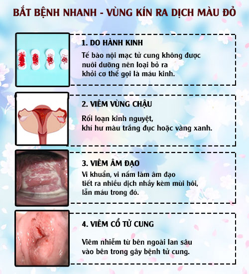 Nguyên nhân vùng kín ra dịch màu đỏ Nguyên nhân vùng kín ra dịch màu đỏ