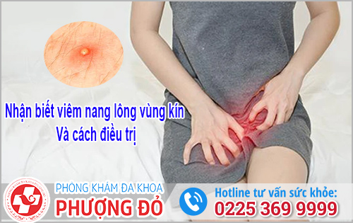 Nhận Biết Viêm Nang Lông Vùng Kín Và Cách Điều Trị