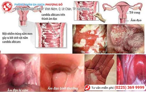 Nước tiểu màu đỏ - Cảnh báo những căn bệnh nguy hiểm Nước tiểu màu đỏ - Cảnh báo những căn bệnh nguy hiểm