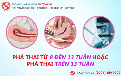 Cách phá thai từ 8 đến 13 tuần, phá thai trên 13 tuần an toàn, không đau Cách phá thai từ 8 đến 13 tuần, phá thai trên 13 tuần an toàn, không đau