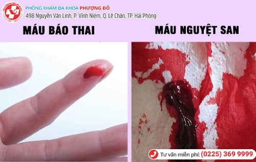 Phân biết máu báo thai và máu nguyệt san Phân biết máu báo thai và máu nguyệt san