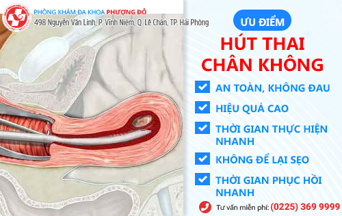 Bỏ thai 2 tháng bằng cách hút thai