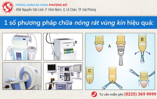 Rát vùng kín do đâu? Địa chỉ chữa trị uy tín hiện nay