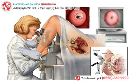 Soi cổ tử cung giúp phát hiện nhiều bệnh Soi cổ tử cung giúp phát hiện nhiều bệnh