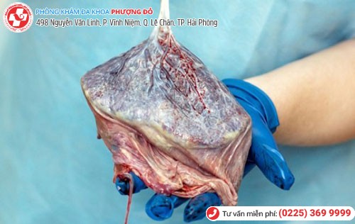 Hình ảnh nhau thai Hình ảnh nhau thai