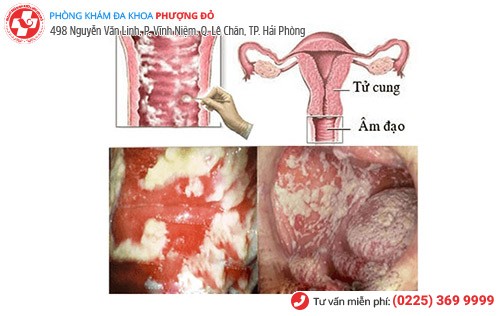 Sưng cửa mình sau khi quan hệ có sao không? Sưng cửa mình sau khi quan hệ có sao không?
