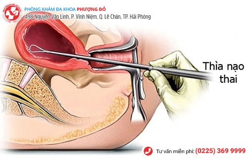 Thai 4 tháng phá được không? Cách phá thai 4 tháng an toàn