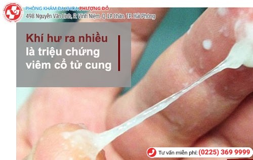 Viêm cổ tử cung khiến khí hư ra nhiều Viêm cổ tử cung khiến khí hư ra nhiều