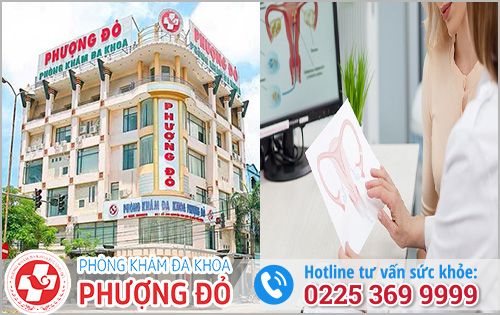 Điều Trị U Nang Buồng Trứng Ở Đâu?