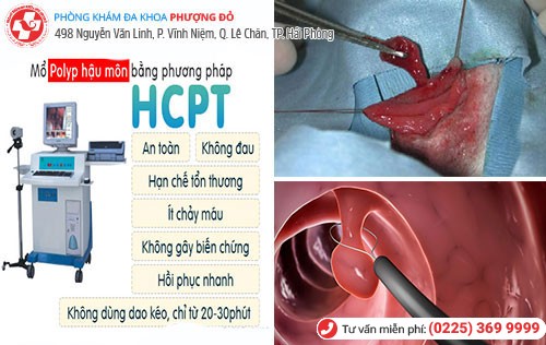 HCPT - phương pháp chữa Polyp hiệu quả hiện nay