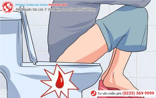 Đi cầu ra máu tươi ở nam và nữ Tình trạng đi cầu ra máu tươi