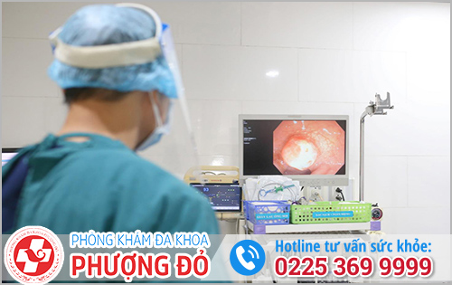 Ở đâu chữa polyp đại tràng tốt?