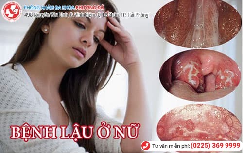 bệnh lậu ở nữ bệnh lậu ở nữ