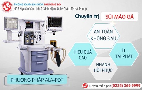 Bị sùi mào gà ở miệng vì quan hệ với trai trẻ Bị sùi mào gà ở miệng vì quan hệ với trai trẻ