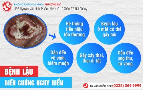 bệnh lậu bệnh lậu