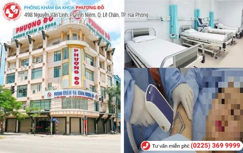 địa chỉ chữa hôi nách địa chỉ chữa hôi nách
