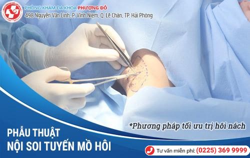 chữa hôi nách chữa hôi nách