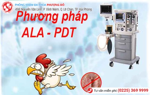 chữa mụn cóc sinh dục