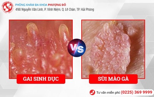 gai sinh dục gai sinh dục