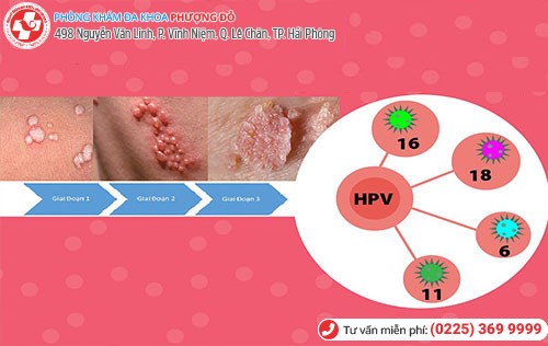 HPV gây sùi mào gà