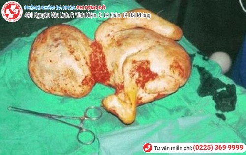 biến chứng herpes sinh dục