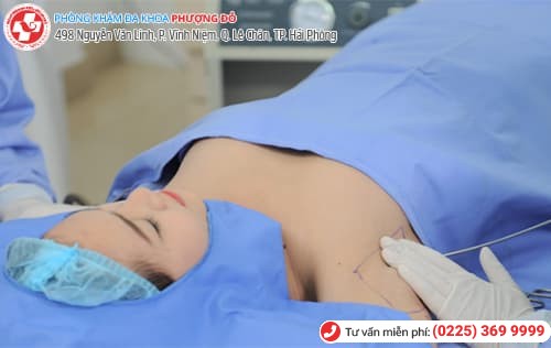 chữa hôi nách hiệu quả