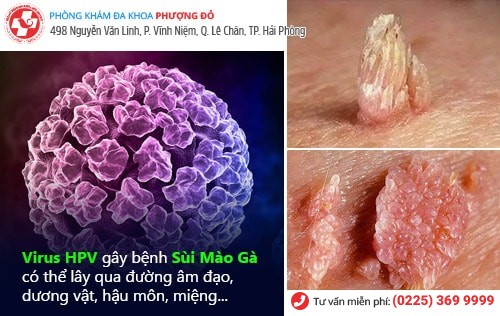 virus HPV virus HPV