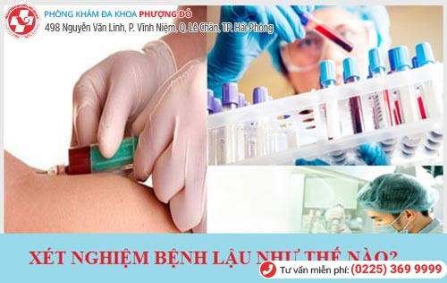 Xét nghiệm bệnh lậu ở đâu ? Xét nghiệm bệnh lậu ở đâu ?