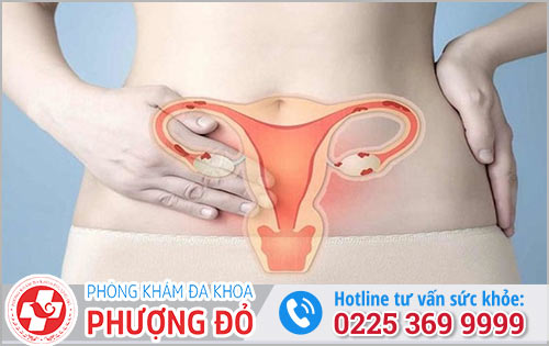 Những Căn Bệnh Tử Cung Nữ Giới Hay Gặp