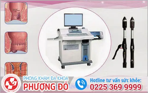 Hỗ trợ điều trị ngứa hậu môn bằng các phương pháp tiên tiến và hiện đại