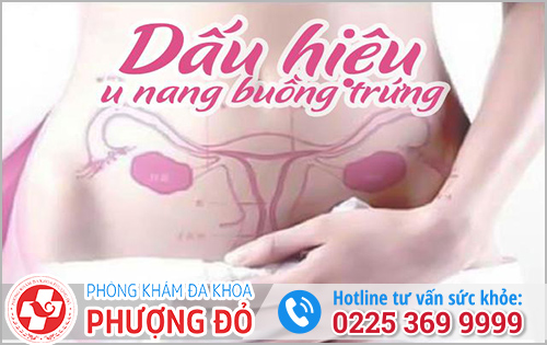 Triệu Chứng Khi Mắc U Nang Buồng Trứng