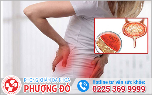 Nguyên Nhân và Triệu Chứng Viêm Bàng Quang Ở Nữ